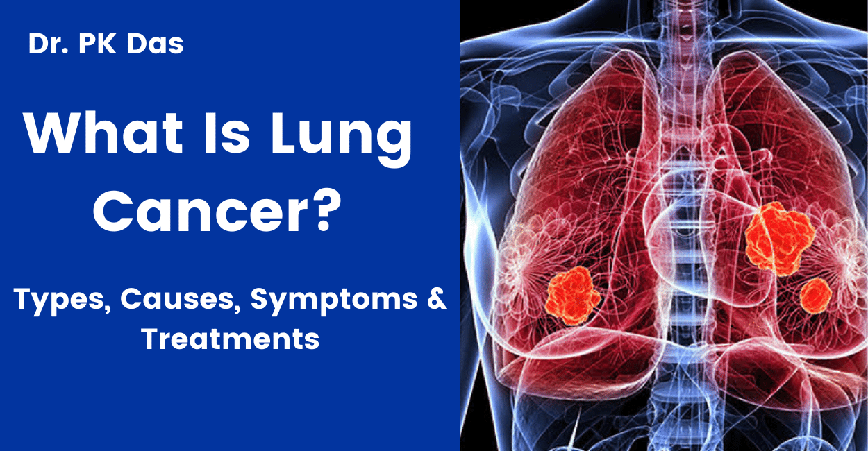 Lung cancer doctor in Delhi NCR
