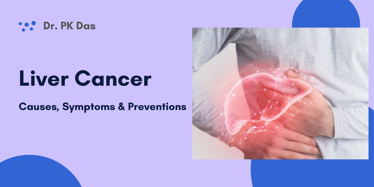 What is Liver Cancer? Causes, Symptoms and Preventions | Dr.PK Das